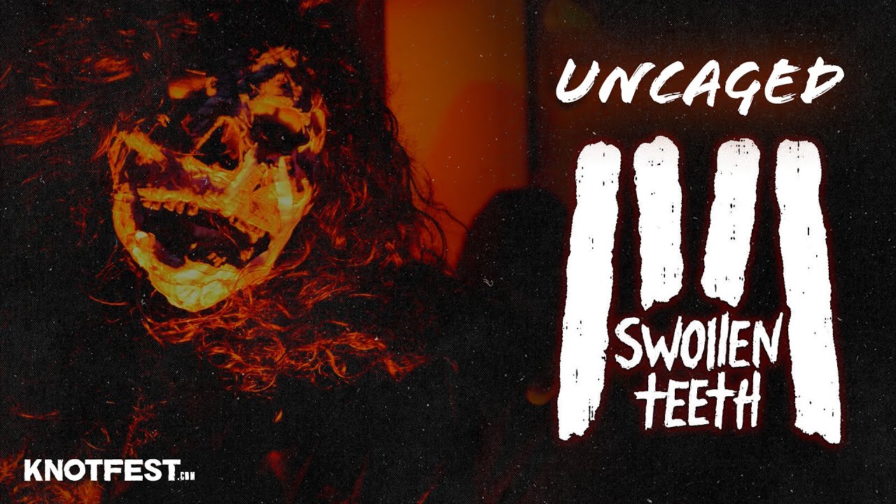 Uncaged: SWOLLEN TEETH